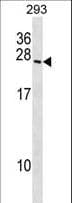 Polyclonal Rabbit anti-Human BOK Antibody (aa1-30, WB)