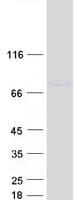 Human SLU7 / 9G8 Protein (Recombinant Myc-DDK (Flag))