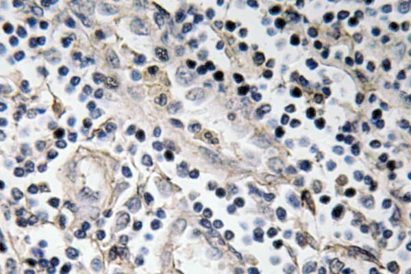 Polyclonal Rabbit anti-Human BMP7 Antibody (aa124-173, IHC, WB)