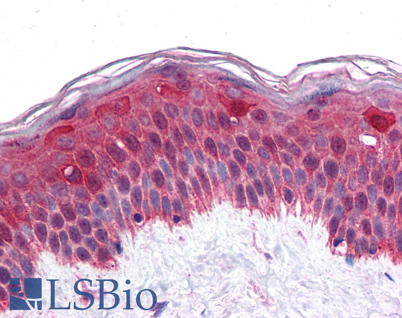 IHC-plus™ LHX8 Antibody