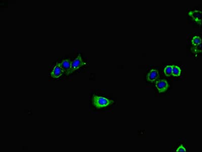 Polyclonal Rabbit anti-Human GUCY1A1 / GUCY1A3 Antibody (IHC, IF)
