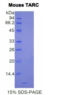 Mouse CCL17 / TARC Protein (Recombinant His)