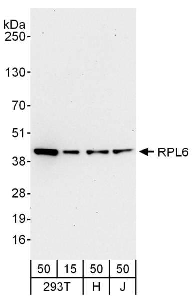 RPL6 / Ribosomal Protein L6 Antibody (aa238-288)