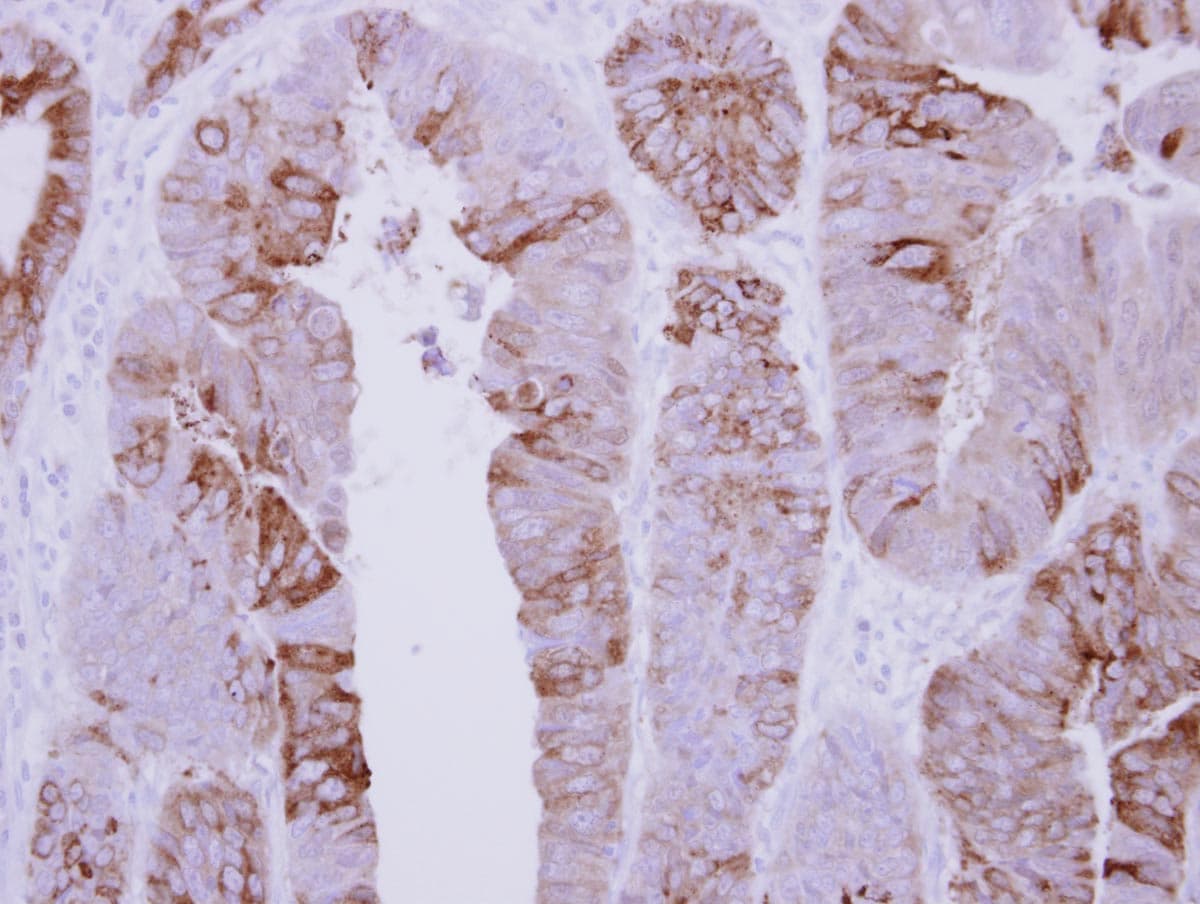 Polyclonal Rabbit anti-Human COLQ Antibody (IHC, WB)
