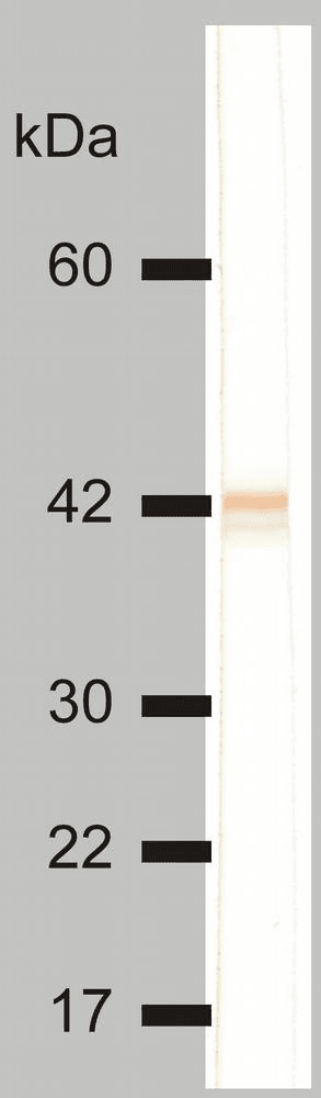 PathPlus™ Monoclonal Mouse anti-Human KRT18 / CK18 / Cytokeratin 18 Antibody (clone DC-10, IHC, WB)