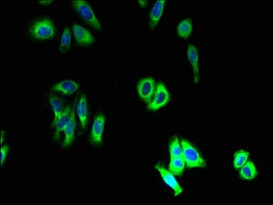 Polyclonal Rabbit anti-Human SLC46A3 Antibody (IHC, WB)