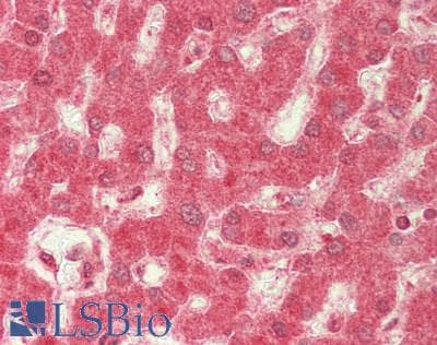 IHC-plus™ Polyclonal Rabbit anti-Human TJP2 / ZO2 / ZO-2 Antibody (IHC, WB)