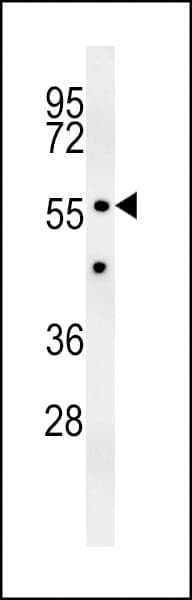 ZNF385B / ZNF533 Antibody (aa1-30)