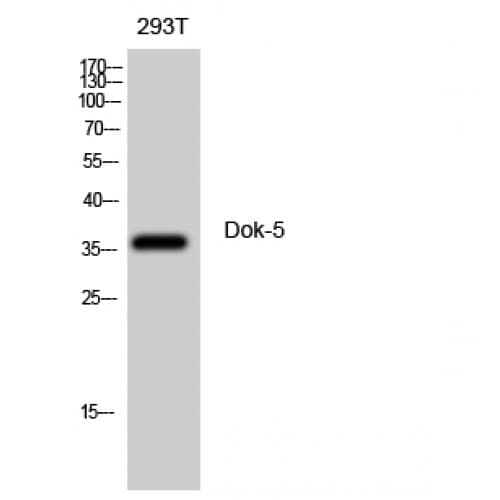 DOK5 Antibody (70-150 aa, Internal)