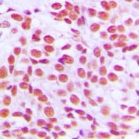 ZIF268 / EGR1 Antibody (C-Terminus)