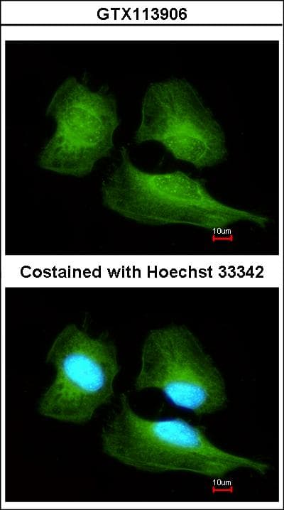 Polyclonal Rabbit anti-Human CUL7 Antibody (aa1370-1698, IHC, WB)