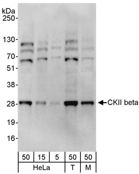IHC-plus™ CSNK2B / Phosvitin Antibody (aa100-150)