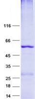 Human ANT2 / SLC25A5 Protein (Recombinant GST, N-terminus + His, C-terminus)