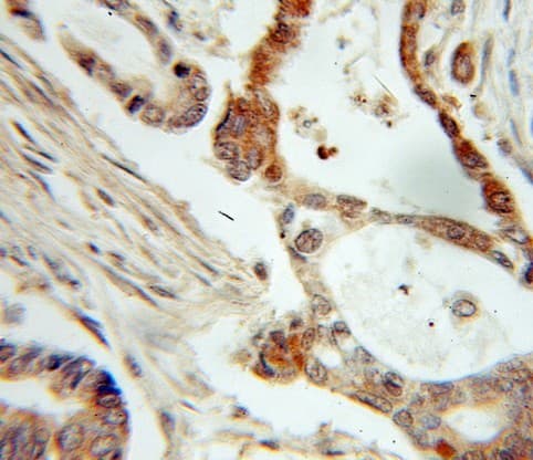 Polyclonal Rabbit anti-Human NME1 / NM23 Antibody (IHC, WB)