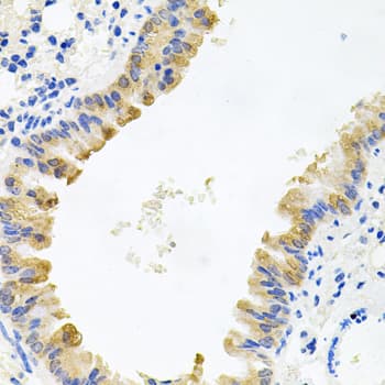 Polyclonal Rabbit anti-Human ALKBH8 Antibody (IHC, IF, WB)