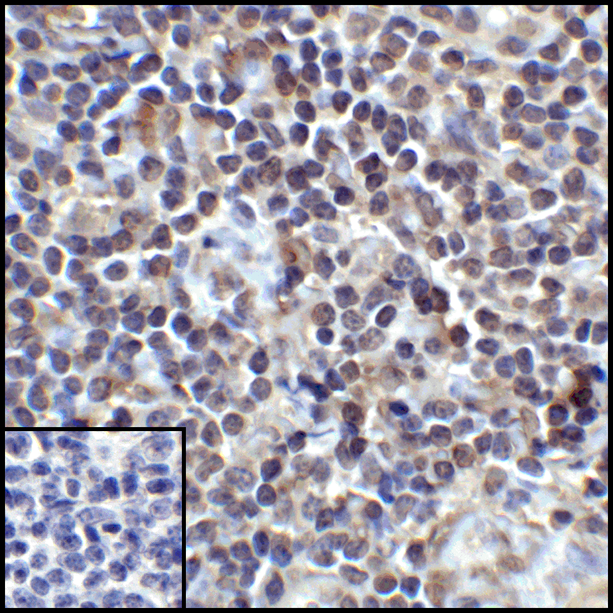 CD274 / B7-H1 / PD-L1 Antibody (clone 1F11)