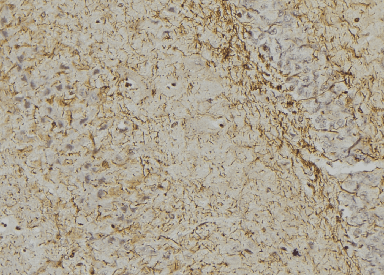 Polyclonal Rabbit anti-Human GFAP Antibody (phospho-Ser38, IHC, IF, WB)