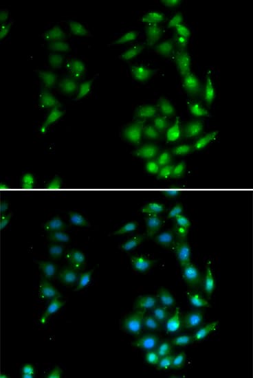 Polyclonal Rabbit anti-Human SOX5 Antibody (aa1-120, IHC, IF, WB)