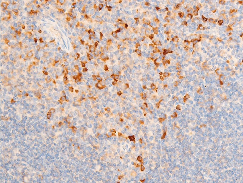 Polyclonal Rabbit anti-Human NFKBIE / IKB Epsilon Antibody (phospho-Ser22, IHC, IF, WB)