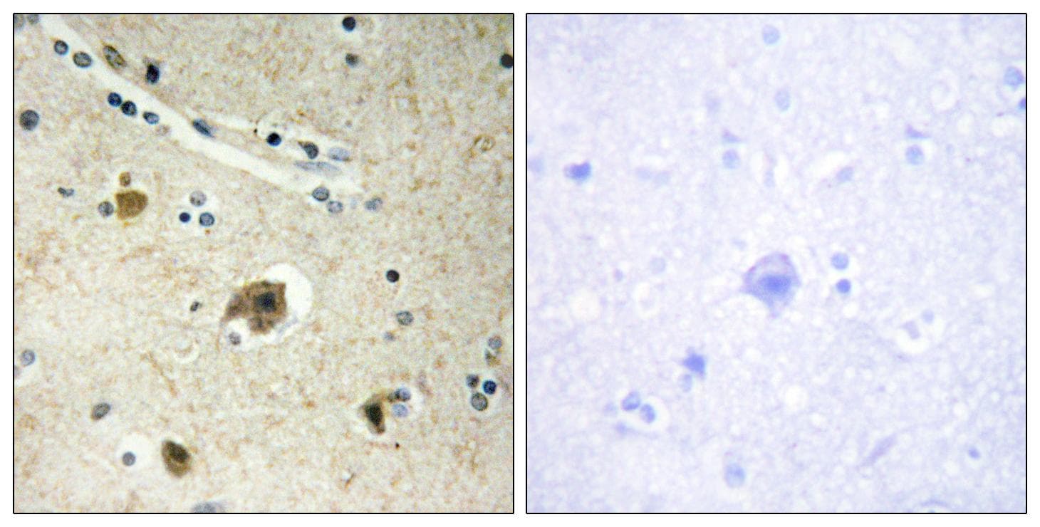 COL4A4 / Collagen IV Antibody