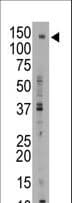 ABCB11 / BSEP Antibody (aa1038-1067)