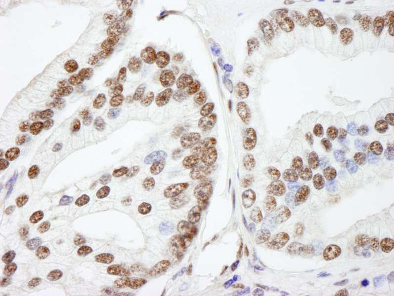 Polyclonal Rabbit anti-Human NUCKS1 Antibody (aa1-50, IHC, IF)