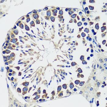 Polyclonal Rabbit anti-Human CCDC124 Antibody (IHC)