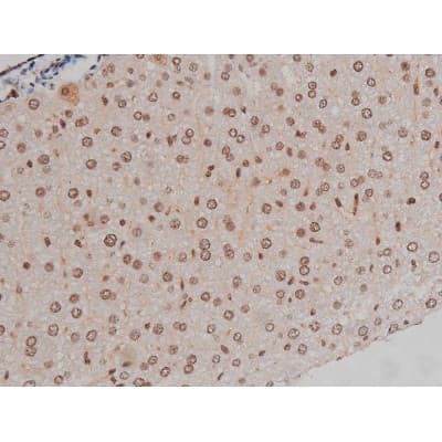 IGF1R / IGF1 Receptor Antibody (phospho-Tyr1346)