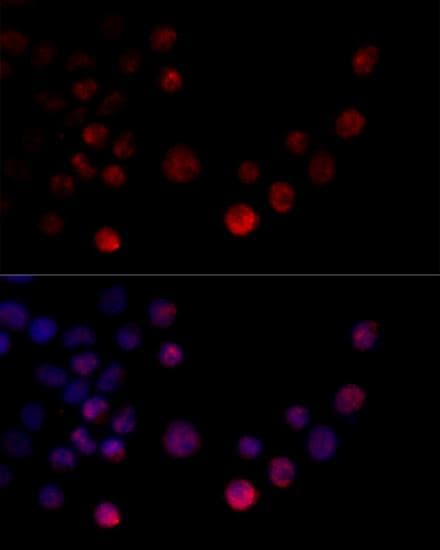 HNRNPH2 / hnRNP H2 Antibody