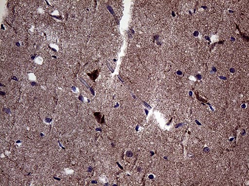 DIRAS2 Antibody (aa1-196, clone OTI10G5)