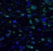 FOS / c-FOS Antibody