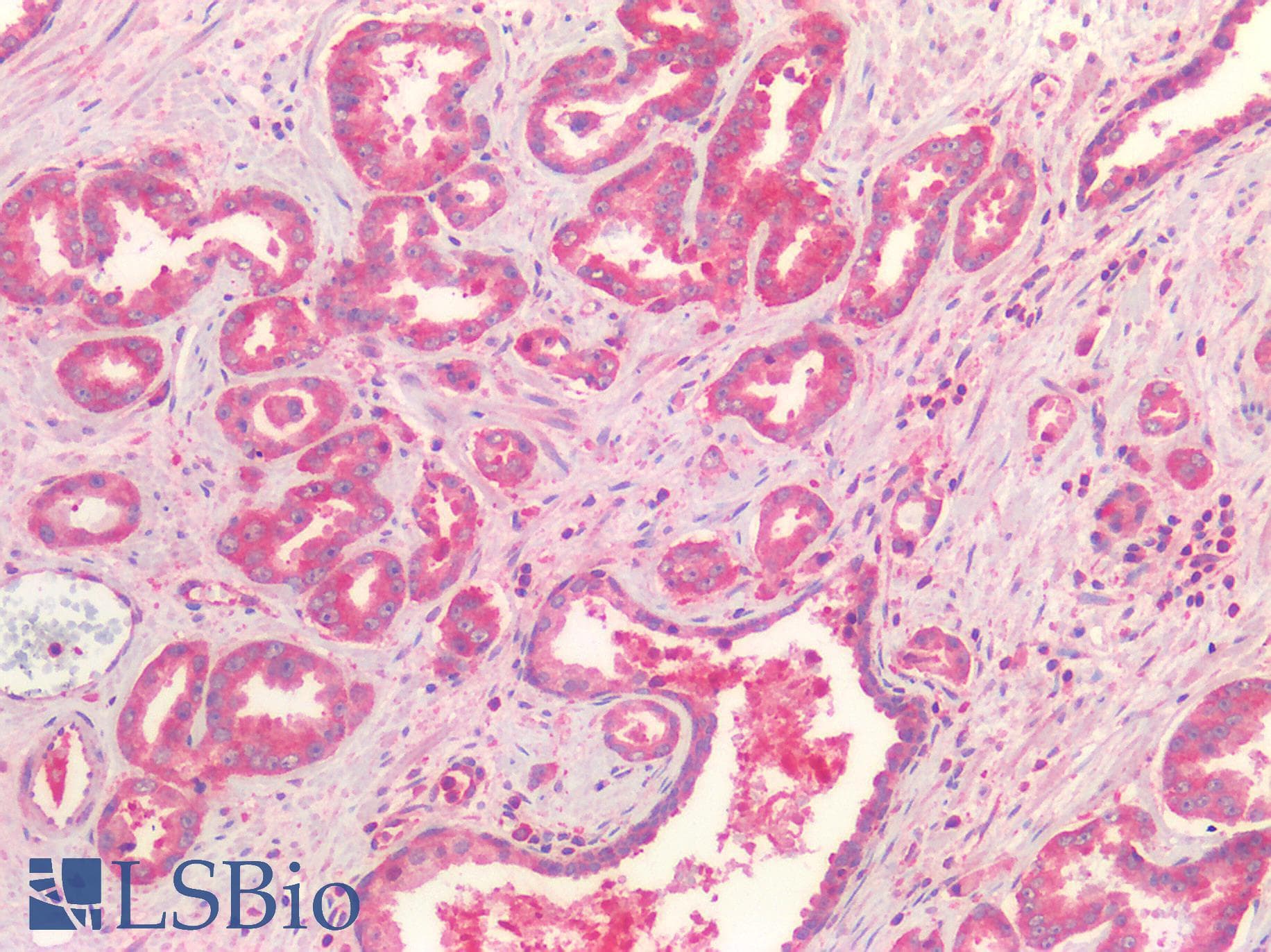 IHC-plus™ FZD7 / Frizzled 7 Antibody (N-Terminus)