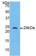TLR5 Antibody (aa46-205)