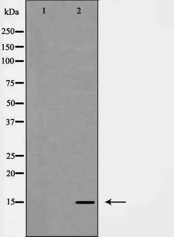 Polyclonal Rabbit anti-Human LGALS7 / Galectin 7 Antibody (WB)