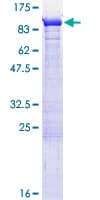 Human SEPT9 / Septin 9 Protein (Recombinant GST)