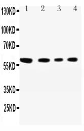 SYNCAM / CADM1 Antibody (aa73-92)