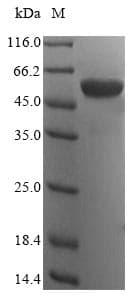 Human ATP5A1 / ATP Synthase Alpha Protein (Recombinant 6His, N-terminus)