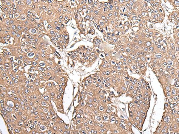 Polyclonal Rabbit anti-Human KRT73 / Keratin 73 Antibody (IHC)