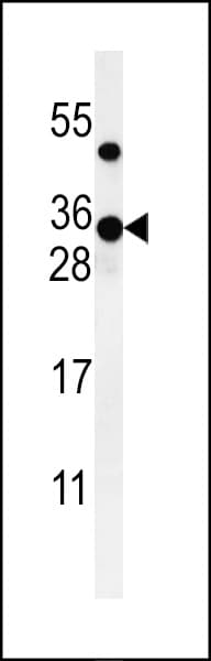 ZCCHC24 Antibody (aa136-165)