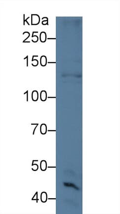 SPECC1 / CYTSB Antibody (aa961-1063)