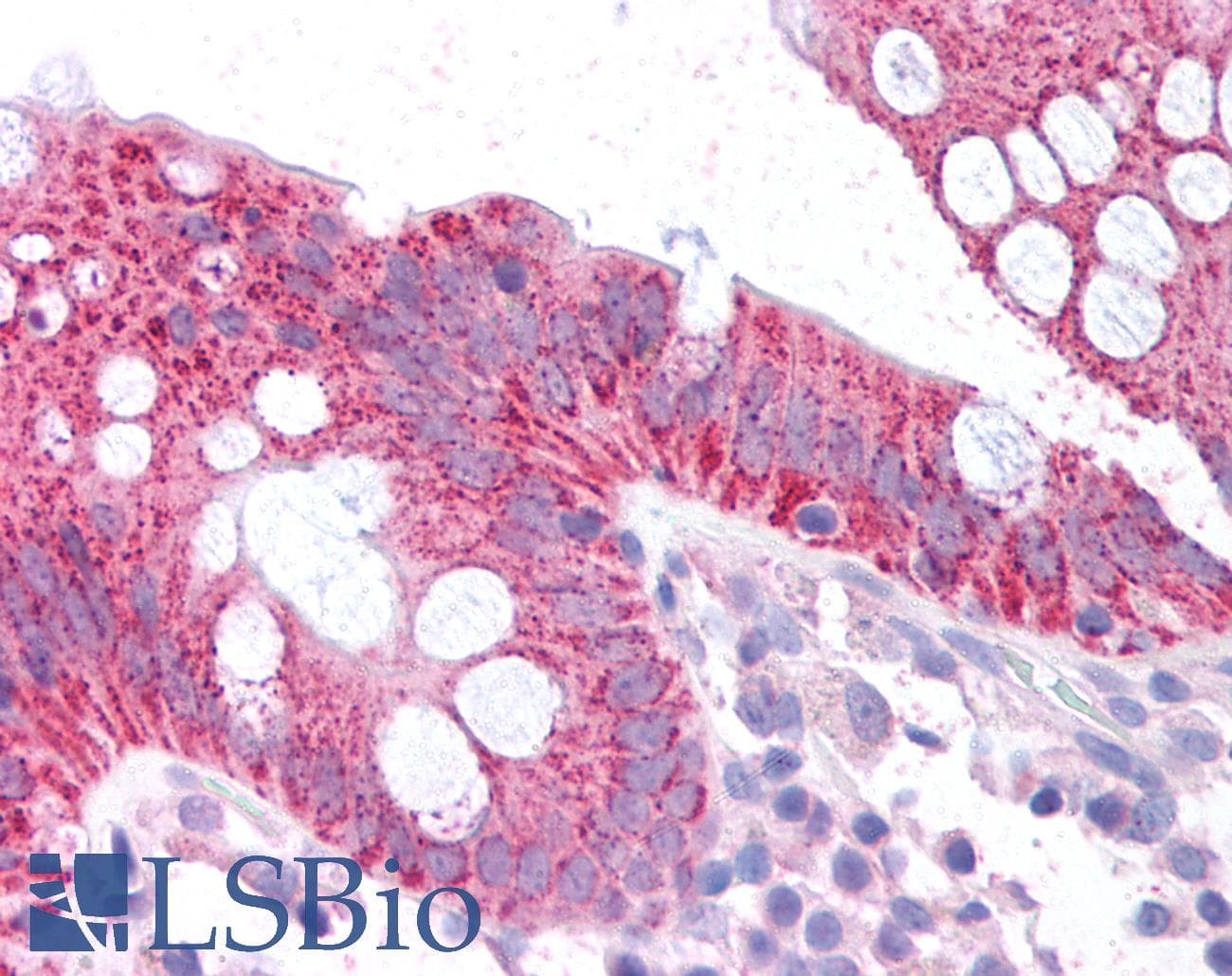 IHC-plus™ p16INK4a / CDKN2A Antibody