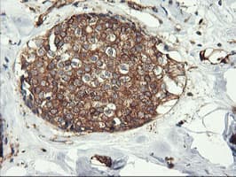 ENPEP / Aminopeptidase A Antibody (clone OTI3G1)