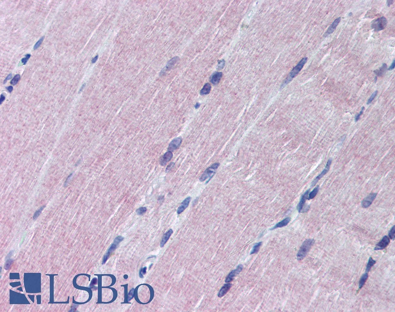 IHC-plus™ Polyclonal Rabbit anti-Mouse MAP2K6 / MEK6 / MKK6 Antibody (N-Terminus, IHC, WB)