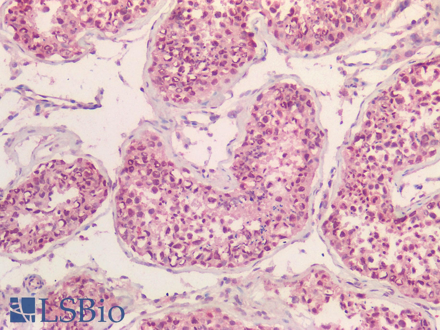 IHC-plus™ Polyclonal Rabbit anti-Human NALP3 / NLRP3 Antibody (Internal Region, IHC)