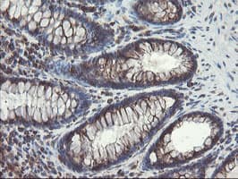 GCP60 / ACBD3 Antibody (clone OTI1G2)