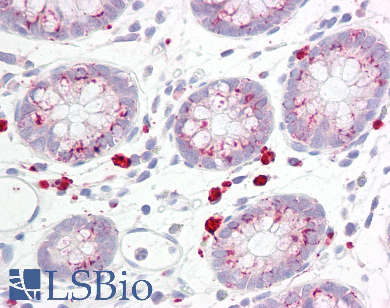 IHC-plus™ Polyclonal Rabbit anti-Human SKP1 Antibody (aa41-90, IHC, WB)