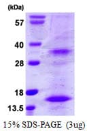 Human BST2 Protein (Recombinant His)