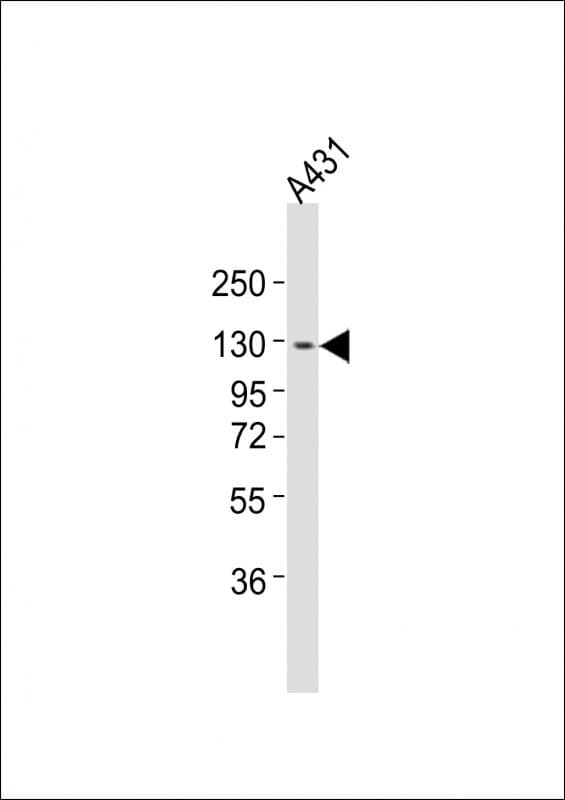 Polyclonal Rabbit anti-Human ITGA7 / Integrin Alpha 7 Antibody (aa247-279, WB)