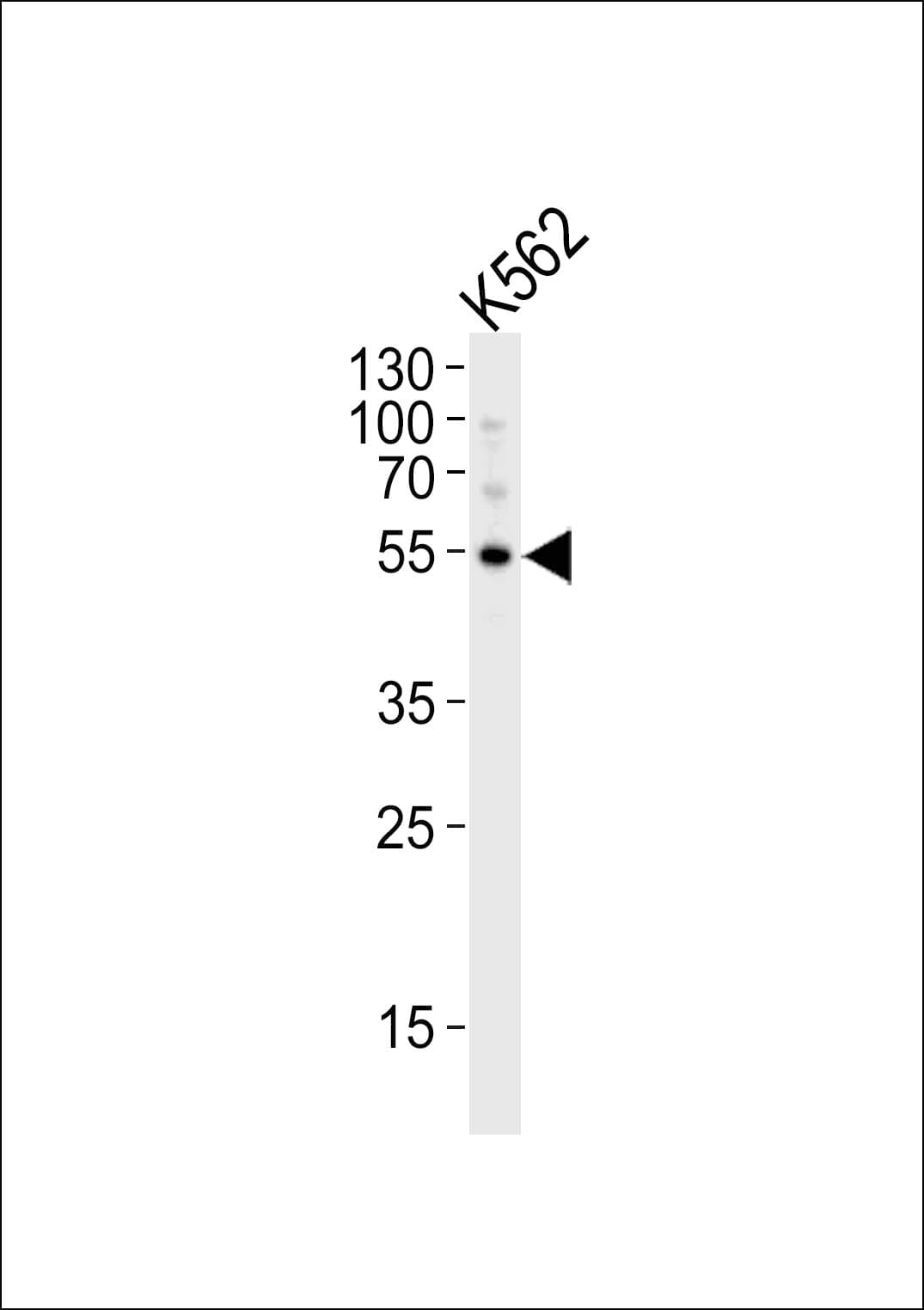 APG5 / ATG5 Antibody