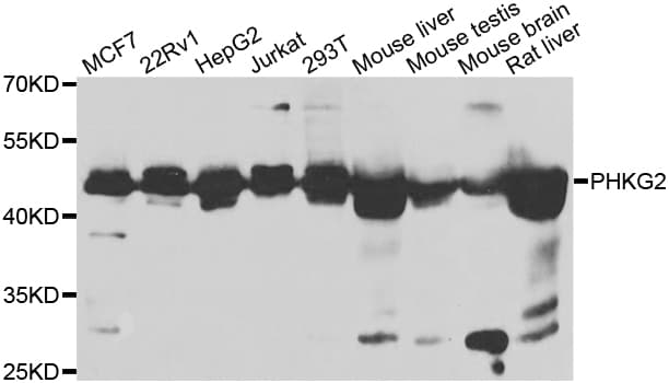 PHKG2 Antibody